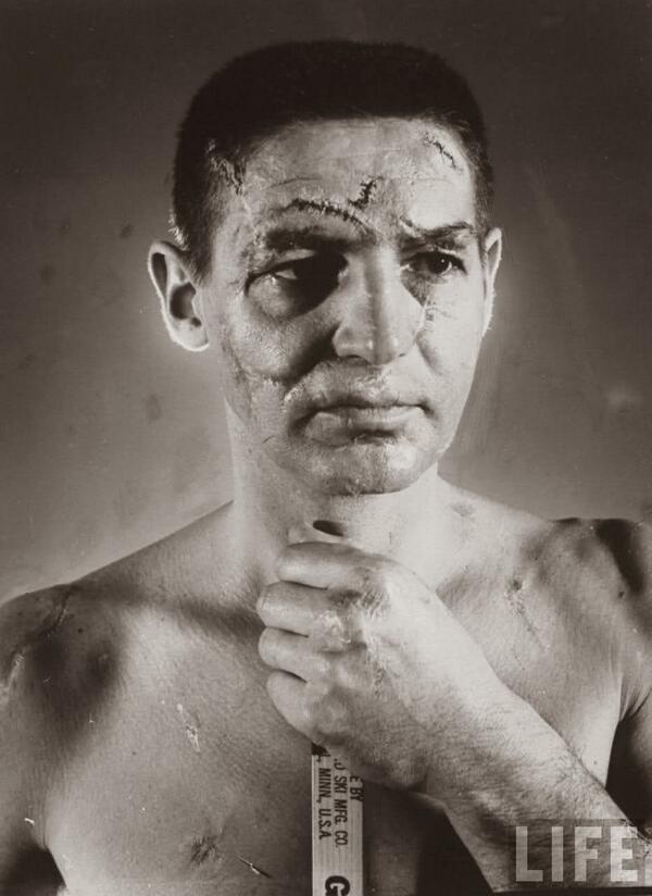 Terry Sawchuk - Il volto di un portiere di hockey prima dell'uso standard delle maschere, 1966