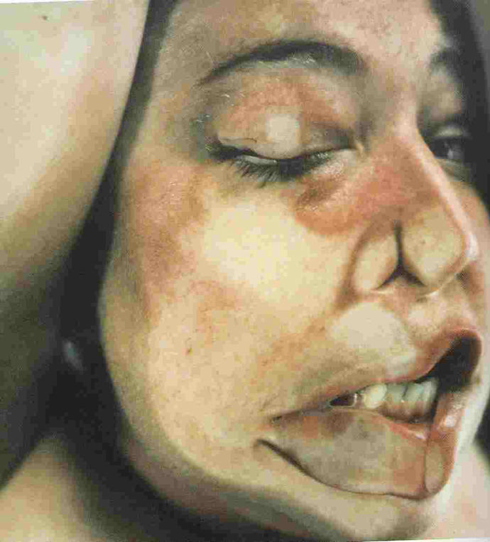 Jenny Saville e Glen Luchford