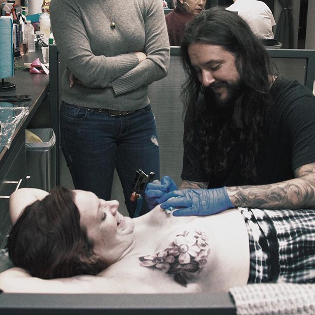 David Allen - Mastectomy