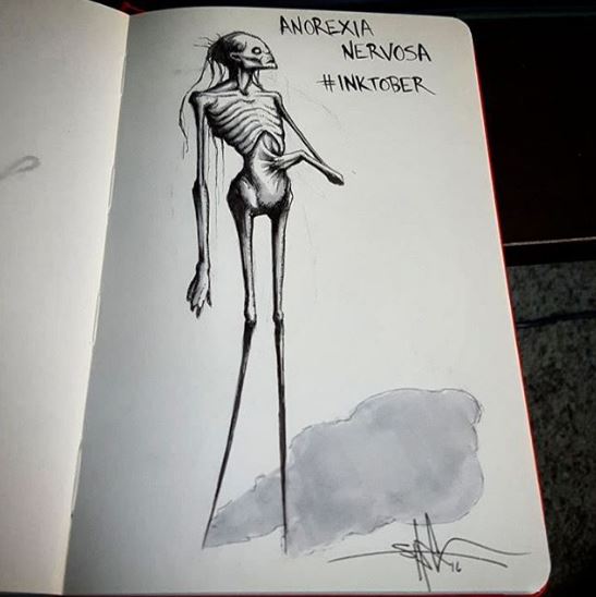 Shawn Coss - Anoressia nervosa