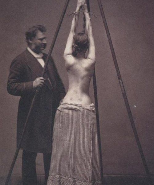 Medico ispeziona una donna che soffre di scoliosi durante il 19 ° secolo