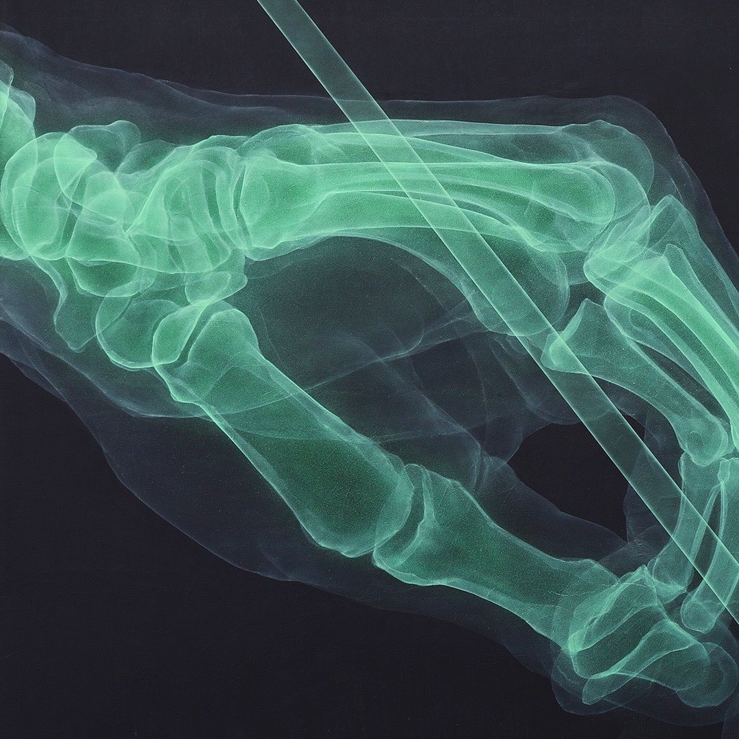 Shok_1 @ Le Locle, Switzerland Shok_1 @ Le Locle, Switzerland